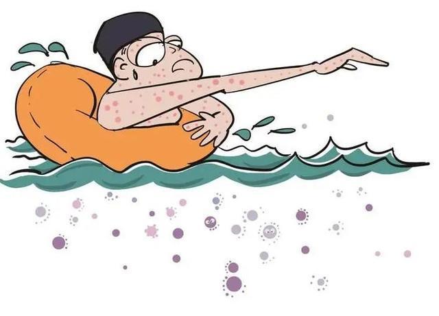 1756801358893033.jpeg 游泳池細菌2.jpeg